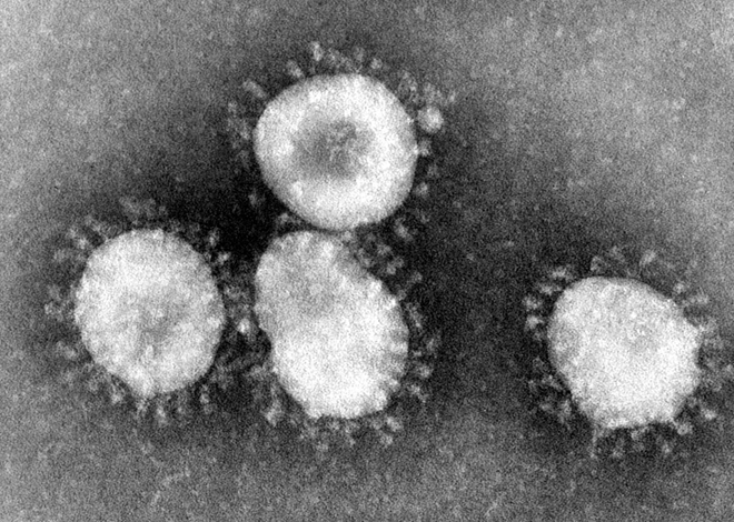 SARS coronavirus gây Hội chứng hô hấp cấp tính nặng /// wikipedia