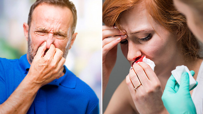 Các triệu chứng phổ biến nhất của ung thư mũi và xoang là: Mũi bị nghẹt không rõ nguyên nhân; Cảm thấy đau tức sau mũi hoặc trong răng; Hỉ mũi ra máu /// Ảnh minh họa: Shutterstock