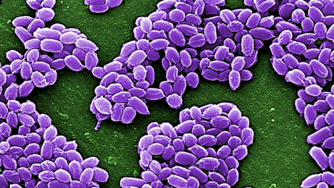 Vi khuẩn bệnh than được phóng to dưới kính hiển vi /// Reuters