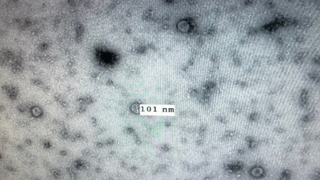 Virus Corona mới đã được Viện Vệ sinh dịch tễ T.Ư phân lập, chụp qua kính hiển vi trong Labo tại viện /// Ảnh: Tư liệu Viện Vệ sinh dịch tễ T.Ư
