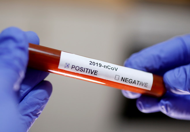 Ống nghiệm chứa mẫu máu dương tính với vi rút Corona mới /// Reuters