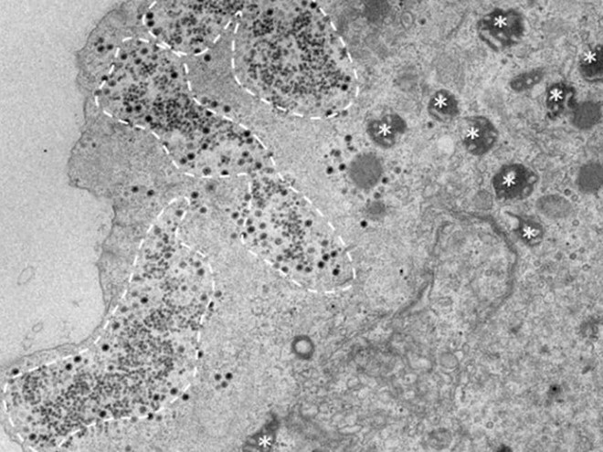 Yaravirus qua kính hiển vi /// HU-MARSEILLE/MICROSCOPY CENTRE UFMG-BELO HORIZONTE 