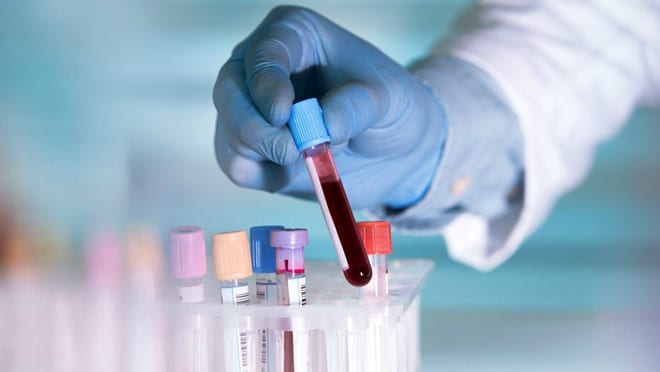 Nghiên cứu mới: nhóm máu A có nguy cơ nhiễm COVID-19 cao hơn - ảnh 1
