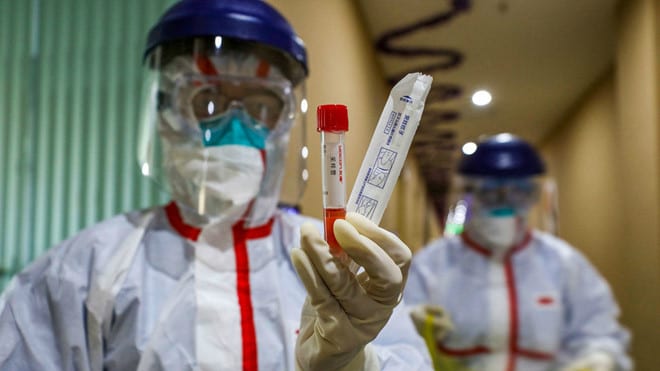 Nhân viên bệnh viện ở Vũ Hán cầm mẫu xét nghiệm của người nghi nhiễm virus Corona chủng mới /// AFP