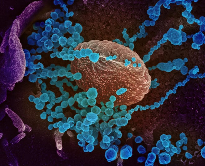 SARS-CoV-2 (các chấm tròn nhỏ) phát triển từ tế bào nuôi cấy trong phòng thí nghiệm
 /// Ảnh: AFP
