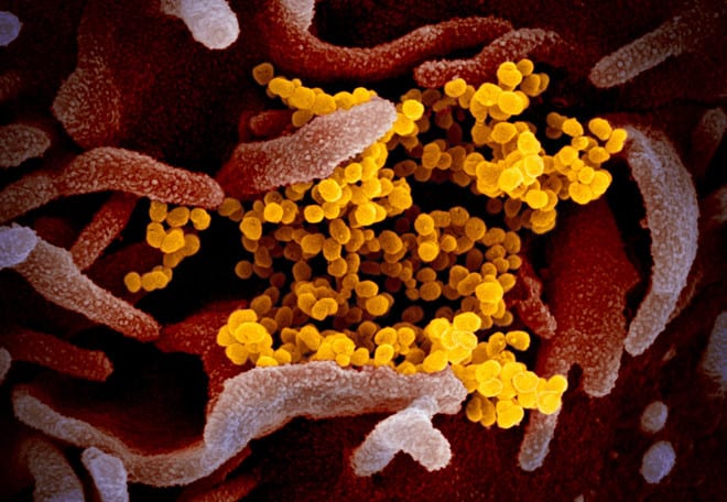 Hình ảnh virus Corona chủng mới (màu vàng) bám vào tế bào người /// Ảnh chụp màn hình GemoneWeb