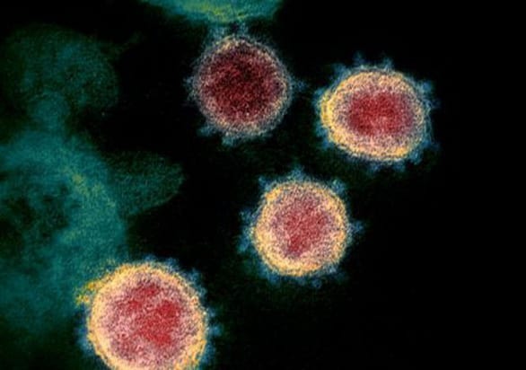 Tìm thấy xúc tu nguy hiểm trong cấu tạo của virus gây COVID-19 - Ảnh 1.