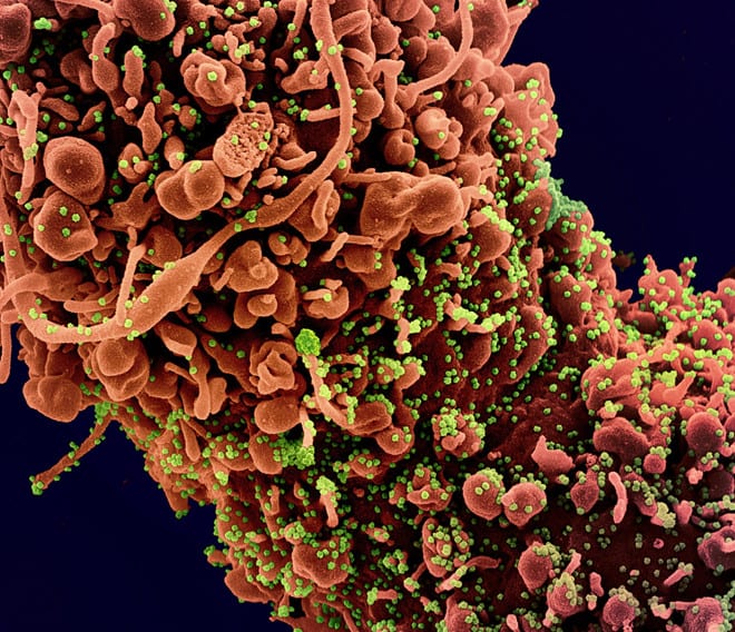 Hình ảnh phóng to virus Corona bám vào tế bào ở người /// Ảnh chụp màn hình SCMP