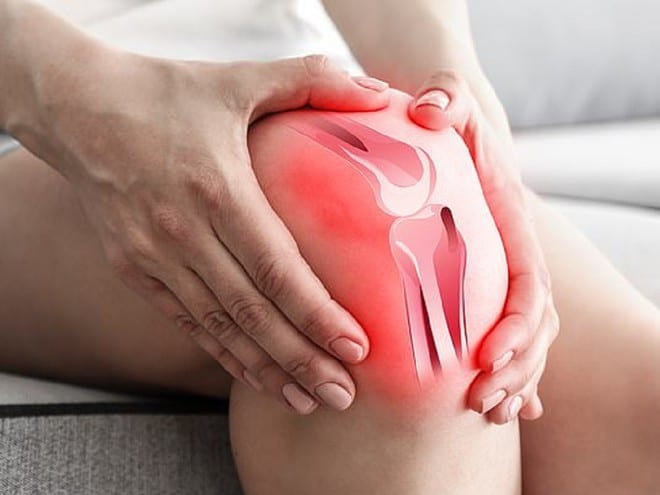 Đầu gối đau kèm theo biểu hiện sưng, đỏ thì có thể là do viêm bao hoạt dịch khớp gối /// Ảnh minh họa: Shutterstock