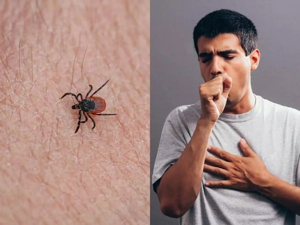 Virus lây từ bọ ve cắn làm 7 người chết, 60 người nhiễm bệnh tại Trung Quốc - Ảnh 1.