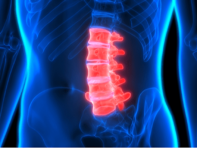 4 dấu hiệu đau dọc sống lưng là do viêm khớp cột sống - ảnh 1