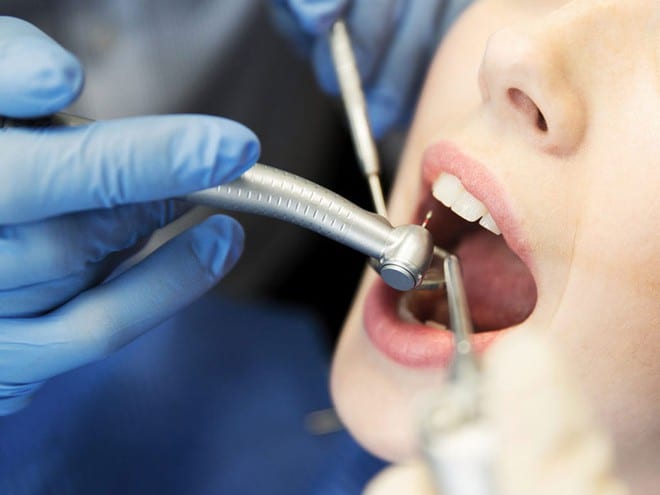 Tình trạng viêm nướu và răng có thể liên quan đến tình trạng viêm nhiễm trong cơ thể và gan. Nên thường xuyên vệ sinh và kiểm tra răng miệng. /// Ảnh minh họa: Shutterstock