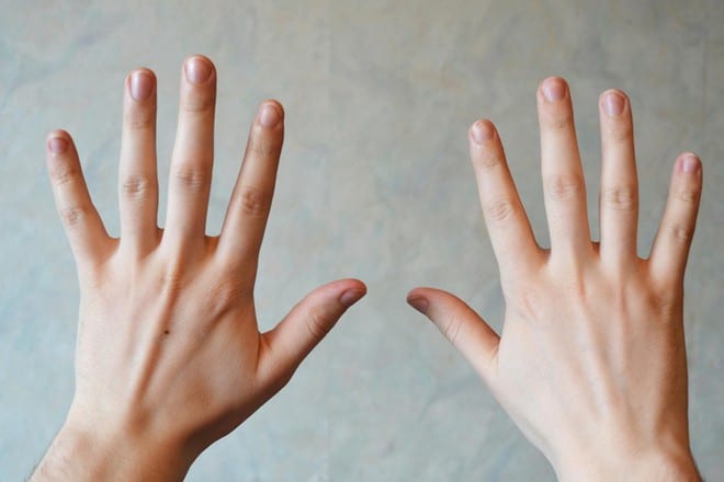 7 dấu hiệu trên móng tay cảnh báo bệnh tật của bạn - ảnh 1
