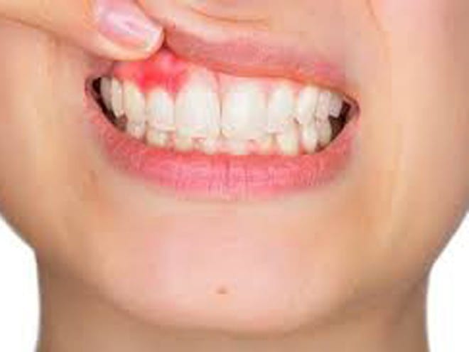 Răng và nướu có thể đưa ra những tín hiệu tinh tế về sức khỏe tổng thể của bạn /// Ảnh minh họa: Shutterstock