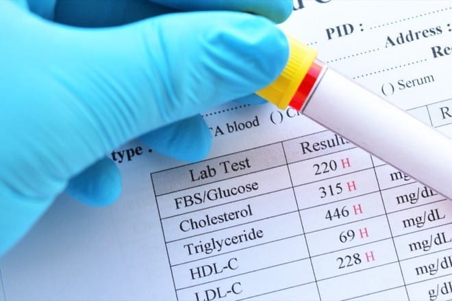 Nên xét nghiệm máu định kỳ để phát hiện sớm bệnh tiểu đường /// Ảnh minh họa: Shutterstock