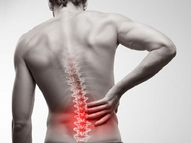 Bạn còn trẻ và thường xuyên gặp phải tình trạng đau lưng, thì có thể là do viêm cột sống dính khớp /// Ảnh minh họa: Shutterstock