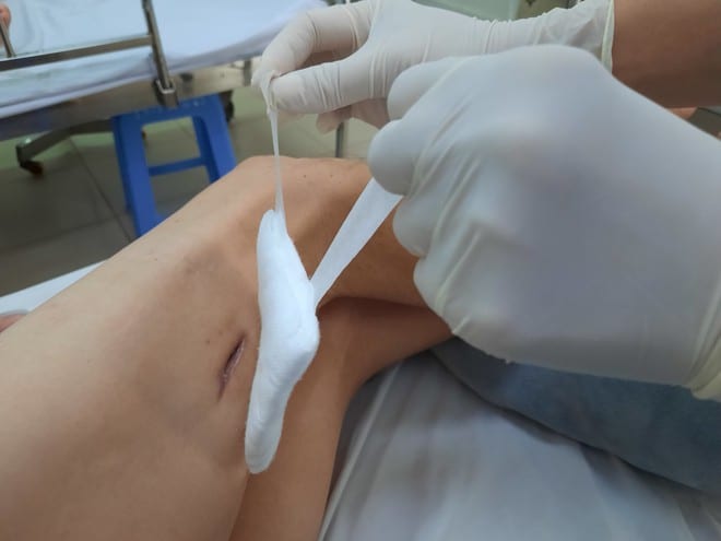 Bệnh viện Đà Nẵng báo động tình trạng các ca bệnh Whitmore liên tục tăng - ảnh 2