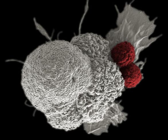 Tin vui: tìm ra chất làm thuốc trị ung thư mới khiến tế bào ung thư ‘chết đói‘ - Ảnh 1.