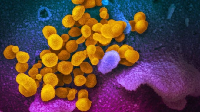 Virus SARS-CoV-2 dưới kính hiển vi /// Ảnh: Reuters