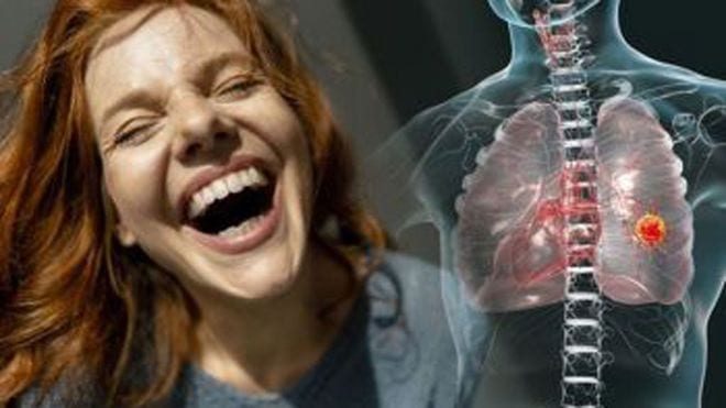 Đau ngực - thường nặng hơn khi cười là một triệu chứng phổ biến của ung thư phổi /// Ảnh minh họa: Shutterstock 