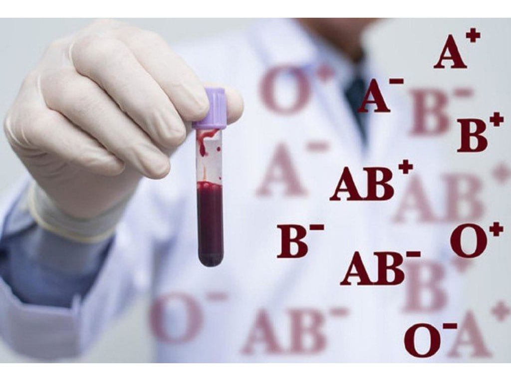Người thuộc nhóm máu A, B hoặc AB có thể tăng nguy cơ đột quỵ sớm /// SHUTTERSTOCK