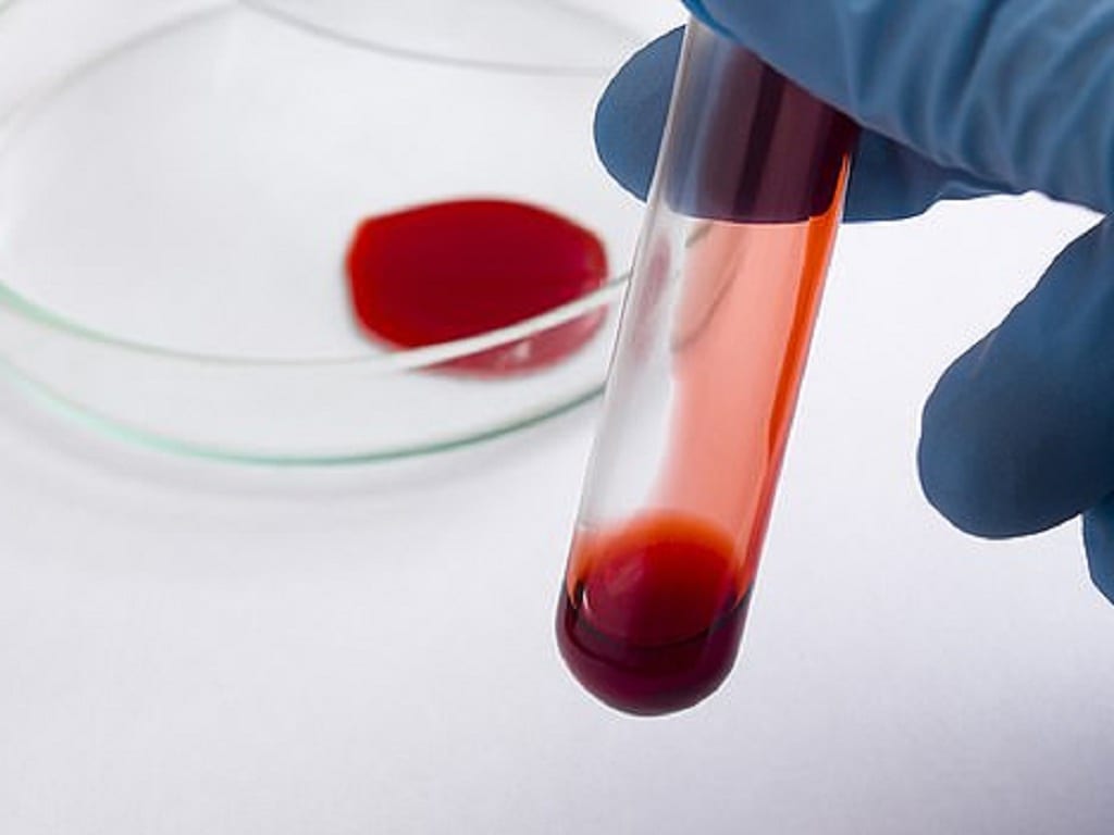 Nghiên cứu cho rằng những người có nhóm máu O có nguy cơ bị rối loạn chảy máu cao hơn /// Ảnh: Shutterstock