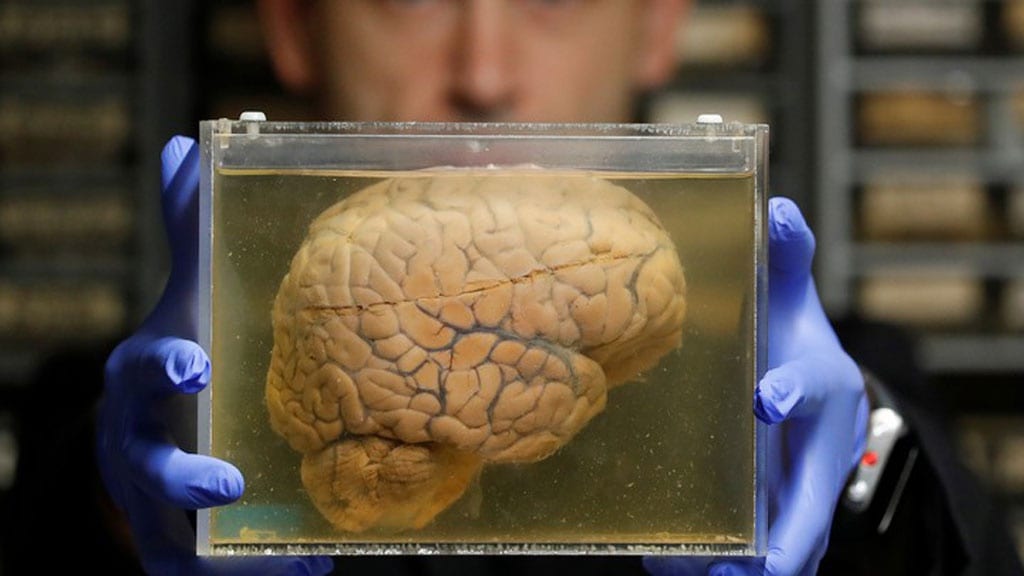 Bộ não con người /// REUTERS