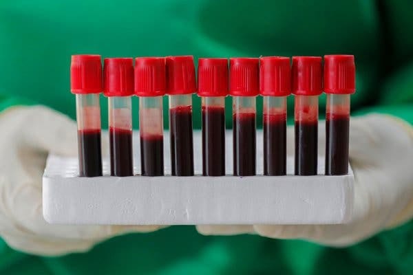 Nhóm máu là một trong những yếu tố có thể dẫn đến nguy cơ ung thư cao hơn /// Shutterstock