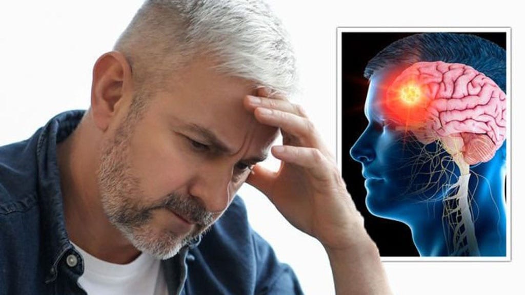 Có 5 dấu hiệu chính để nhận biết cơn đau đầu có thể là dấu hiệu của khối u não /// Ảnh minh họa: Shutterstock
