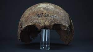 Hộp sọ của người đàn ông 20 tuổi chết vì dịch hạch vào khoảng 5.000 năm trước /// Chụp màn hình ABC