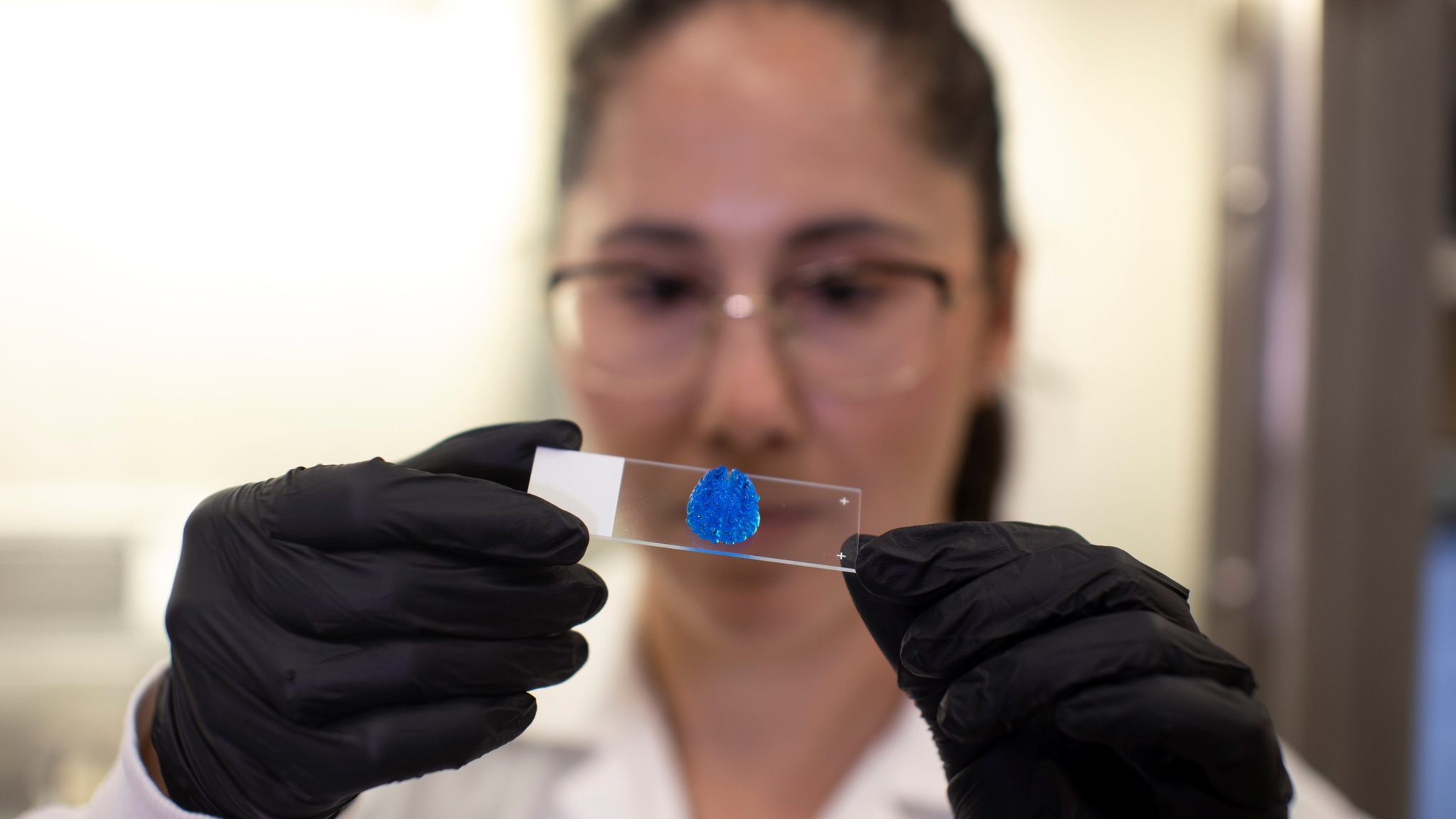 Nhà khoa học tại Đại học Tel Aviv kiểm tra mẫu khối u ác tính được in 3D /// Reuters