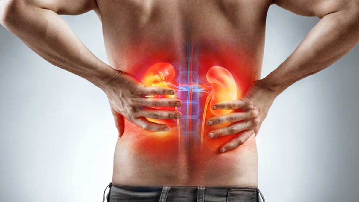 Cách nhận biết cơn đau lưng của bạn là bệnh thận - ảnh 1