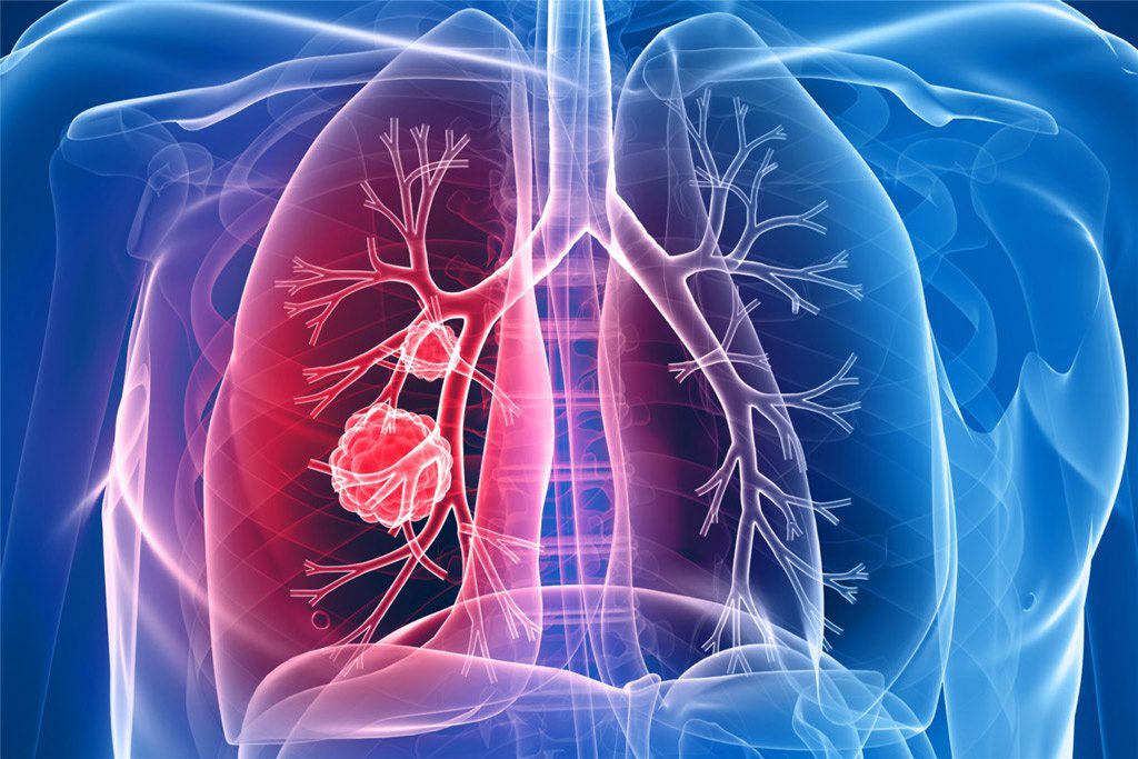 Thêm một loại quả đặc biệt ức chế khối u, bảo vệ phổi - ảnh 2