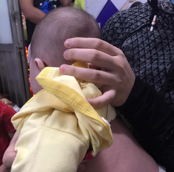 Cảnh giác khi bé 4 tháng tuổi sốt xuất huyết giả dạng là sốt phát ban - Ảnh 1.